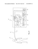 MEDICAL DEVICE AND METHOD FOR DETERMINING A DYSSYNCHRONICITY MEASURE     TECHNICAL FIELD diagram and image