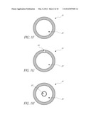 METHOD AND APPARATUS FOR TREATMENT OF INTRACRANIAL HEMORRHAGES diagram and image