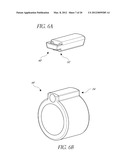 METHOD AND APPARATUS FOR TREATMENT OF INTRACRANIAL HEMORRHAGES diagram and image