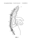 WEARABLE DEVICE FOR FINGER REHABILITATION diagram and image