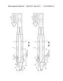 SPLIT-TIP CATHETER INCLUDING LATERAL DISTAL OPENINGS diagram and image