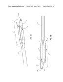 SPLIT-TIP CATHETER INCLUDING LATERAL DISTAL OPENINGS diagram and image