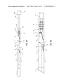 SPLIT-TIP CATHETER INCLUDING LATERAL DISTAL OPENINGS diagram and image