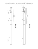 SPLIT-TIP CATHETER INCLUDING LATERAL DISTAL OPENINGS diagram and image