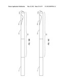 SPLIT-TIP CATHETER INCLUDING LATERAL DISTAL OPENINGS diagram and image