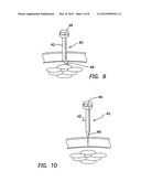 SURGICAL ACCESS PORT AND METHOD OF USING SAME diagram and image