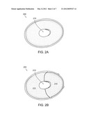 MODULAR IMPLANTABLE MEDICAL DEVICE diagram and image