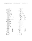 MODULAR IMPLANTABLE MEDICAL DEVICE diagram and image