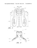 ANCHORING SYSTEM FOR USE WITH NEONATES diagram and image