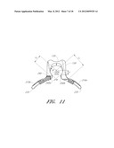 ANCHORING SYSTEM FOR USE WITH NEONATES diagram and image