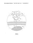 Microwave Spacers and Method of Use diagram and image