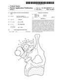 BONE FIXING SYSTEM AND METHOD OF USE diagram and image