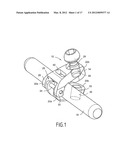 BONE FIXING SYSTEM AND METHOD OF USE diagram and image