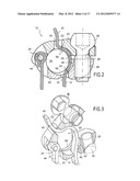 BONE FIXING SYSTEM AND METHOD OF USE diagram and image