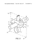 BONE FIXING SYSTEM AND METHOD OF USE diagram and image