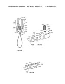 BONE FIXING SYSTEM AND METHOD OF USE diagram and image