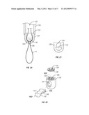 BONE FIXING SYSTEM AND METHOD OF USE diagram and image