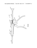 BONE FIXING SYSTEM AND METHOD OF USE diagram and image