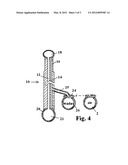 Delivery system and urethra stent for enlarged prostates and method diagram and image