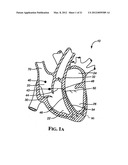 Implantable Micro-Generator Devices with Optimized Configuration, Methods     of Use, Systems and Kits Therefor diagram and image