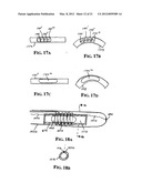 Implantable Micro-Generator Devices with Optimized Configuration, Methods     of Use, Systems and Kits Therefor diagram and image