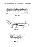 Implantable Micro-Generator Devices with Optimized Configuration, Methods     of Use, Systems and Kits Therefor diagram and image