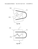 CLOSURE DEVICE AND METHOD diagram and image