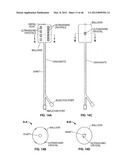 CLOSURE DEVICE AND METHOD diagram and image