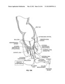 CLOSURE DEVICE AND METHOD diagram and image