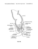 CLOSURE DEVICE AND METHOD diagram and image