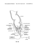 CLOSURE DEVICE AND METHOD diagram and image