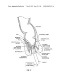 CLOSURE DEVICE AND METHOD diagram and image