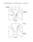 CLOSURE DEVICE AND METHOD diagram and image