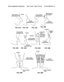 CLOSURE DEVICE AND METHOD diagram and image