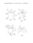 CLOSURE DEVICE AND METHOD diagram and image