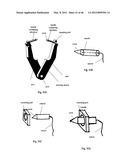 CLOSURE DEVICE AND METHOD diagram and image