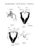 CLOSURE DEVICE AND METHOD diagram and image