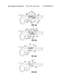 Retractable Ratchet Mechanism for Surgical Instruments diagram and image