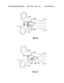 Retractable Ratchet Mechanism for Surgical Instruments diagram and image
