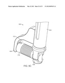 METHODS AND APPARATUS FOR COUPLING A PROSTHESIS TO A SPINAL SEGMENT diagram and image