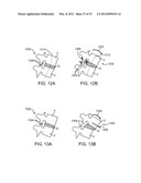 METHODS AND APPARATUS FOR COUPLING A PROSTHESIS TO A SPINAL SEGMENT diagram and image