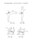 METHODS AND APPARATUS FOR COUPLING A PROSTHESIS TO A SPINAL SEGMENT diagram and image