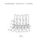 PEDICLE SCREW EXTENSION ALIGNMENT diagram and image