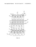 PEDICLE SCREW EXTENSION ALIGNMENT diagram and image