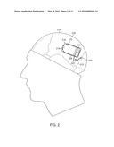 Treatment and warning of recurring therapy and other events using an     implantable device diagram and image