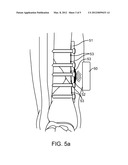 SYSTEMS AND METHODS FOR IMPLANTABLE LEADLESS BONE STIMULATION diagram and image