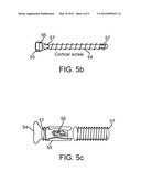 SYSTEMS AND METHODS FOR IMPLANTABLE LEADLESS BONE STIMULATION diagram and image