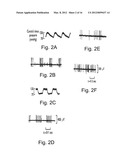 Endovascular Electrostimulation Near a Carotid Bifurcation in Treating     Cerebrovascular Conditions diagram and image