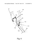 Endovascular Electrostimulation Near a Carotid Bifurcation in Treating     Cerebrovascular Conditions diagram and image