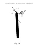 Endovascular Electrostimulation Near a Carotid Bifurcation in Treating     Cerebrovascular Conditions diagram and image